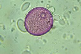 polline_al_microscopio_2.JPG